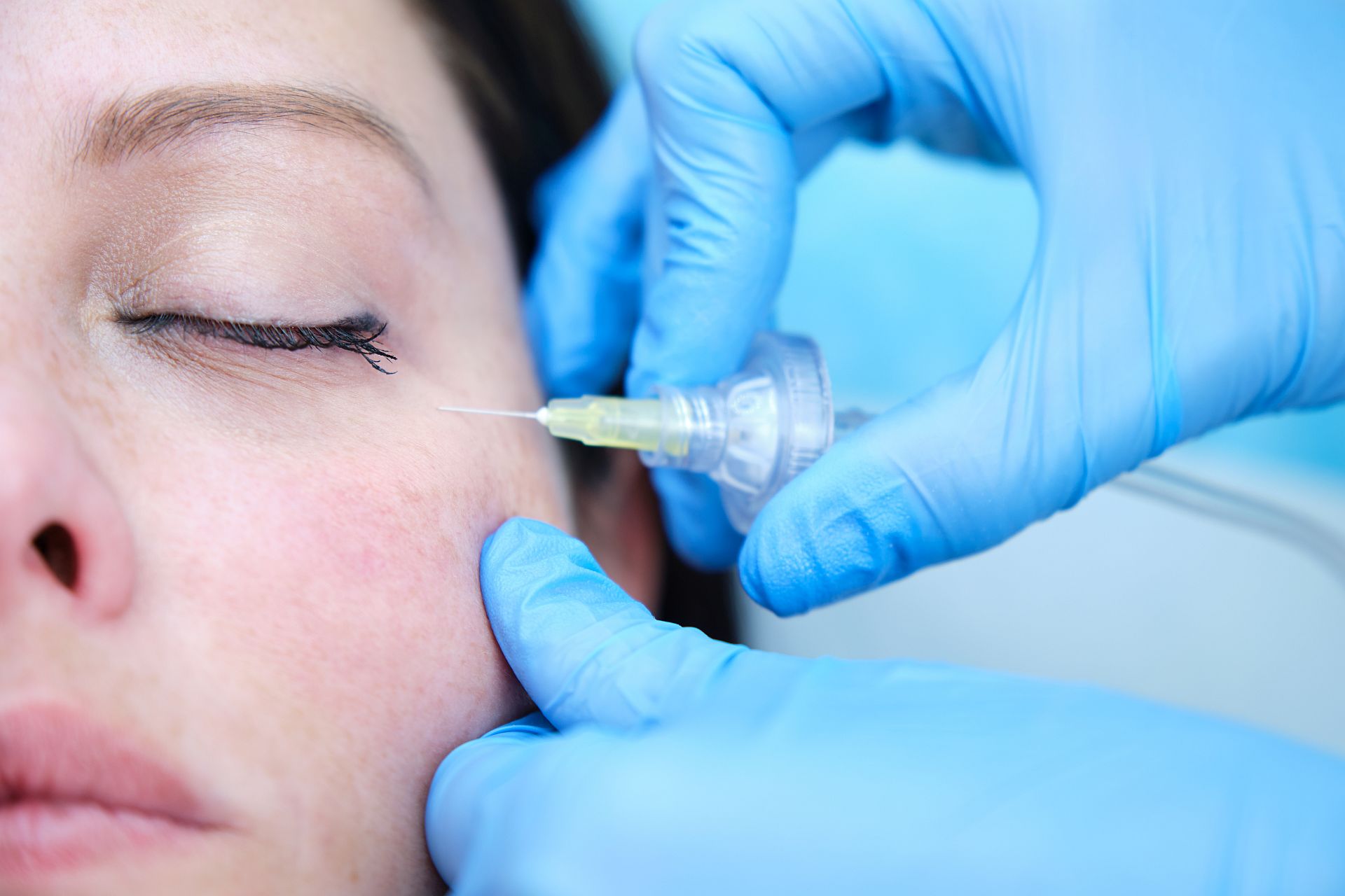 facial carboxytherapy treatment