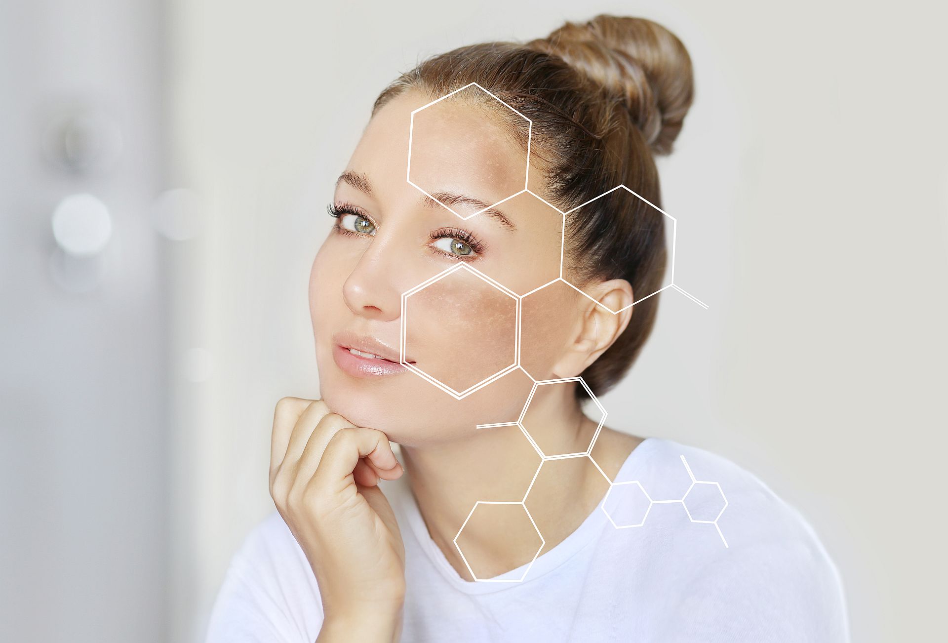 Redukcja przebarwień